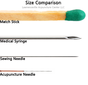 A comparison of a matchstick, hypodermic needle, sewing needle, and an acupuncture needle. The acupuncture needle is by far the smallest in this picture.