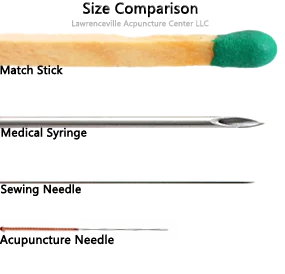 A comparison of a matchstick, hypodermic needle, sewing needle, and an acupuncture needle. The acupuncture needle is by far the smallest in this picture.